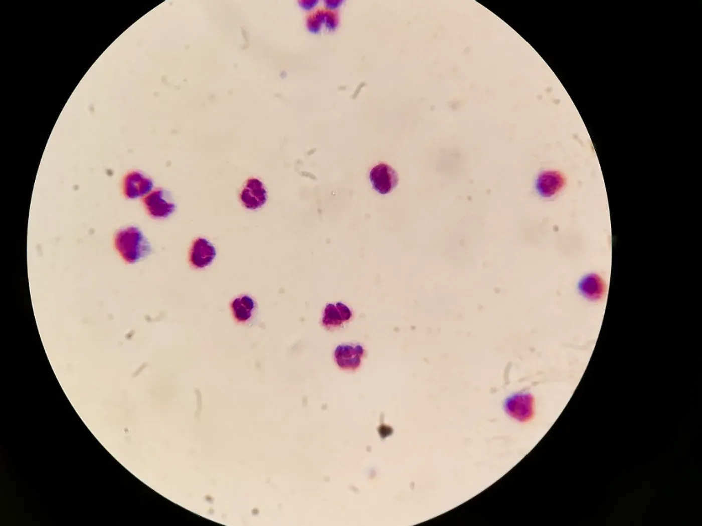 Celleprøve analysert i mikroskop på eget laboratorium